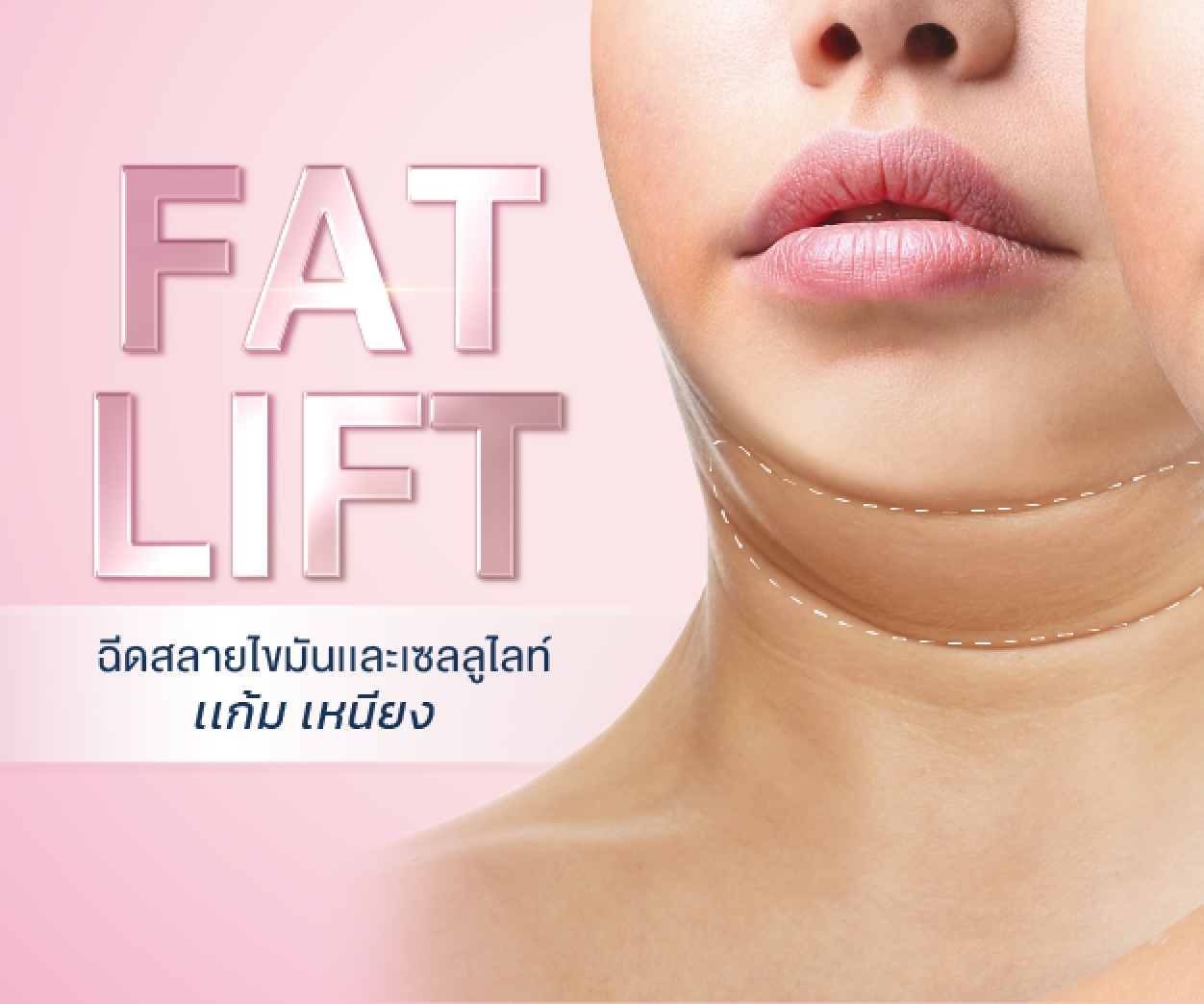 Fat Lift